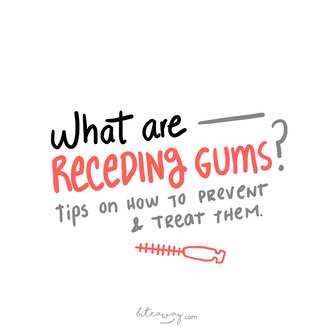 what are recedign gums tips on how to prevent and treat them